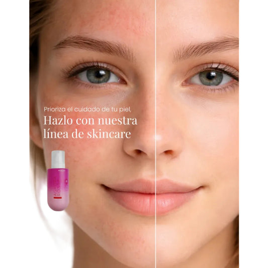 Tónico Facial Aghora Rosse Montoc X 250 mL